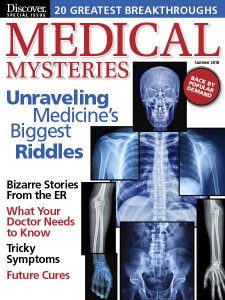 Discover - Medical Mysteries 2018